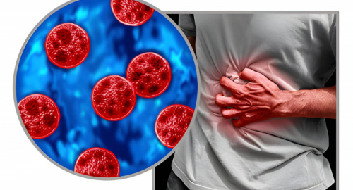Ciclosporiasi negli USA, casi in forte aumento e fonte ancora ignota